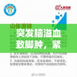 突发脑溢血致脚肿，紧急警示与应对之道