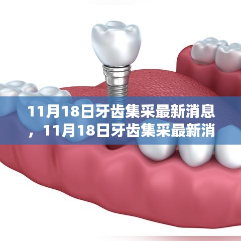 11月18日牙齿集采最新消息，11月18日牙齿集采最新消息全面评测与介绍