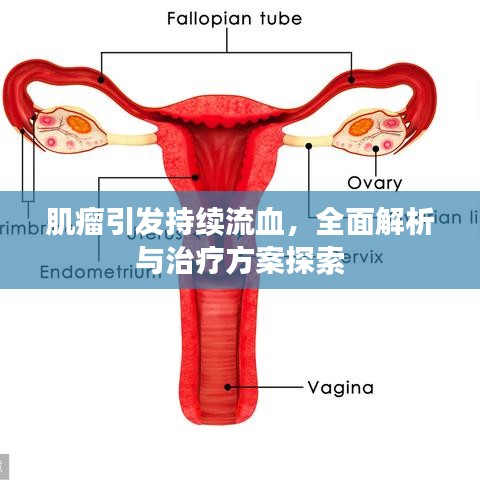 肌瘤引发持续流血，全面解析与治疗方案探索